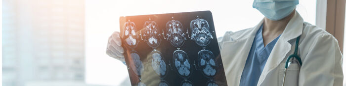 Brain Injury Claims - A Guide for Personal Injury Lawyers